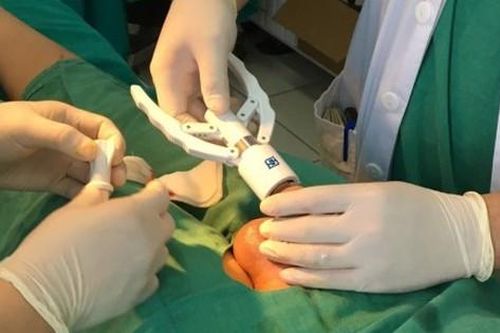 Bệnh nhân tai biến nặng sau thủ thuật cắt bao quy đầu ở bệnh viện tuyến trung ương
