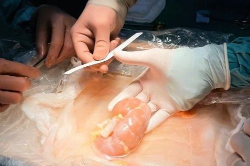 Cô gái trẻ thay đổi cuộc đời cậu bé 15 tuổi dù chưa từng gặp mặt