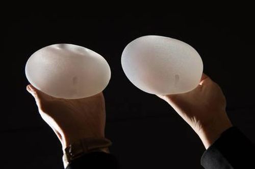 Mối liên hệ giữa túi độn ngực với bệnh ung thư hiếm gặp