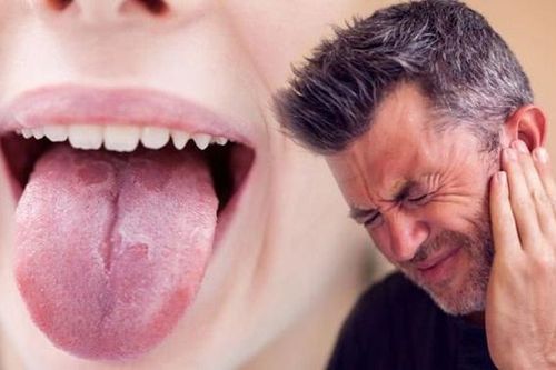 Người đàn ông bị nhiệt miệng, đi khám bàng hoàng khi biết đã ung thư giai đoạn 4