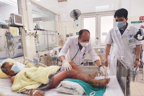 Một ngư dân bị hoại tử bàn chân do nhiễm vi khuẩn Vibrio vulnificus