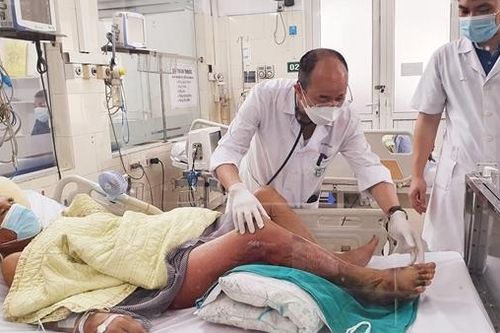 Nhiễm vi khuẩn độc, một ngư dân bị hoại tử chân nguy kịch