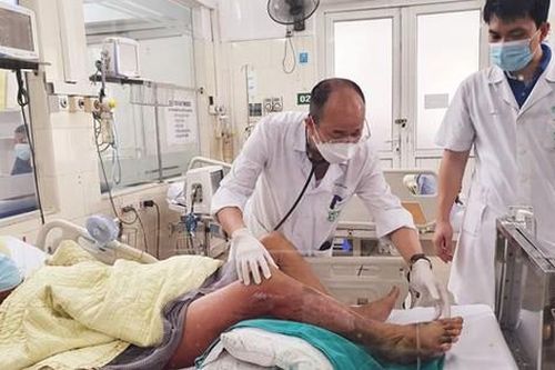 Một ngư dân bị suy gan thận vì nhiễm khuẩn Vibrio Vulnificus
