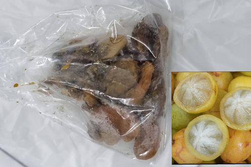 Cụ bà 90 tuổi thủng trực tràng do ăn quả bứa