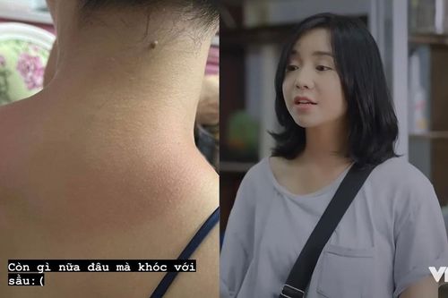 Quỳnh Kool hy sinh vì nghệ thuật, nhìn làn da mà thấy thương!