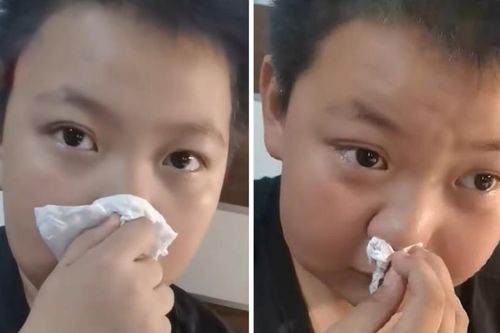 Cậu bé nói bị dị ứng với mùi bài tập về nhà, ủ bệnh trong 5 năm