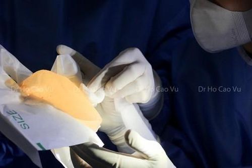 Tặng gói chụp MRI chuyên sâu về nhũ cho phụ nữ tháo túi nâng ngực nhám