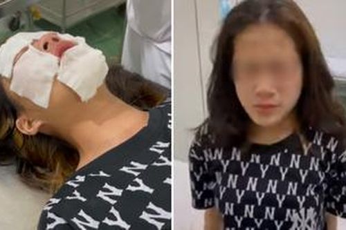 Nữ sinh phải vào viện tâm thần điều trị sau khi bị chọc ghẹo, xịt hơi cay bỏng mặt