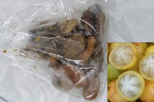Thủng trực tràng do ăn quả măng cụt rừng