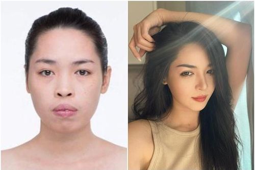 Bất ngờ cuộc sống hiện tại của cô gái Nam Định sau 7 năm thẩm mỹ toàn diện