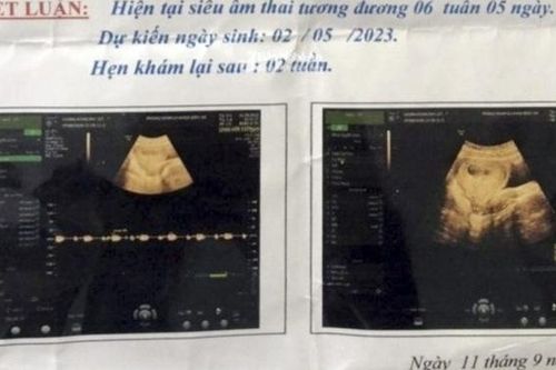 Bắt bảo vệ trường mầm non ở Nghệ An nghi xâm hại học sinh lớp 6 đến mang thai