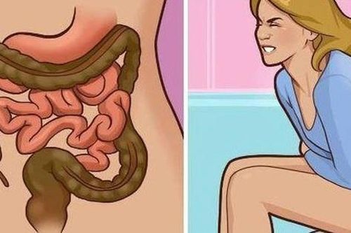 Đi ngoài ra máu, thanh niên 17 tuổi sốc khi được phát hiện ung thư di căn, chuyên gia chỉ rõ dấu hiệu tuyệt đối không chủ quan!