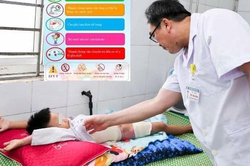Bé 5 tuổi bị nhiễm trùng nặng do đắp thuốc lá trị bỏng