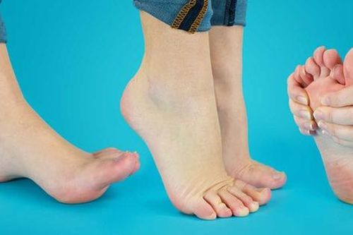 Hai chân quyết định sự lão hóa, muốn sống thọ hãy tập 3 bài tập cho chân