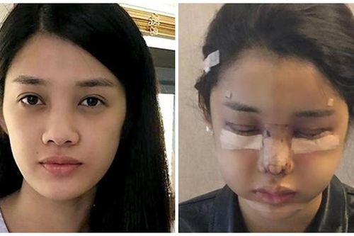 Trình Mỹ Duyên 'đập đi làm lại' gương mặt, nhan sắc giờ thế nào?
