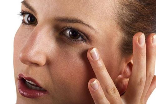 3 cách chữa 'mắt gấu trúc'