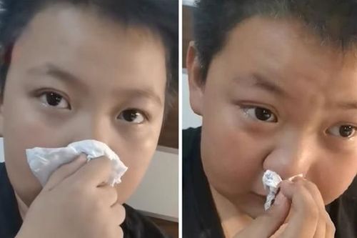 Cậu bé 11 tuổi rơi nước mắt vì dị ứng với 'mùi bài tập về nhà'