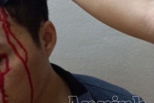 Con trai mua tiết lợn dàn dựng bị bắt cóc, tống tiền mẹ có phạm tội cưỡng đoạt tài sản?