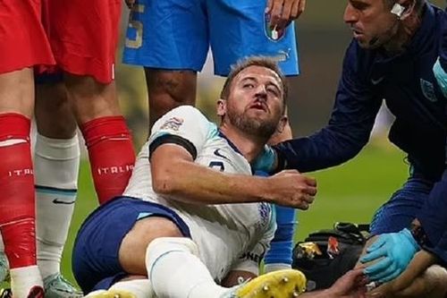 Harry Kane 'đổ máu' không cứu được Tam Sư