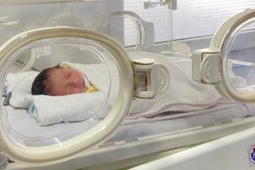 Cứu sống trẻ sinh non mắc nhiều bệnh lý phức tạp, suy hô hấp, nhiễm khuẩn đa kháng