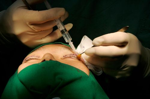 Các cô gái khoe tiêm filler như thể trưng túi hiệu