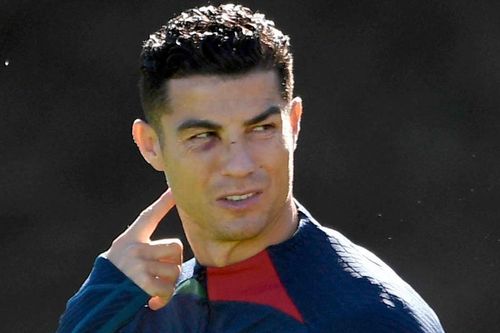 Ronaldo tập luyện với 2 vết thương trên mặt