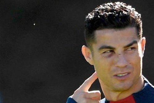 Mắt Ronaldo thâm 1 bên trong buổi tập mới nhất của Bồ Đào Nha