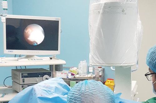 Tán sỏi san hô 'khủng' cho bệnh nhân có nhiều bệnh nền phức tạp