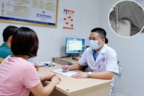 Que cấy tránh thai 'đi lạc' sâu trong cơ bắp tay bệnh nhân