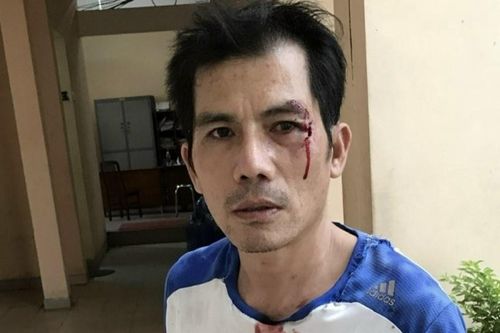 Bắt tạm giam người phụ nữ dùng đá ném vào mặt hàng xóm