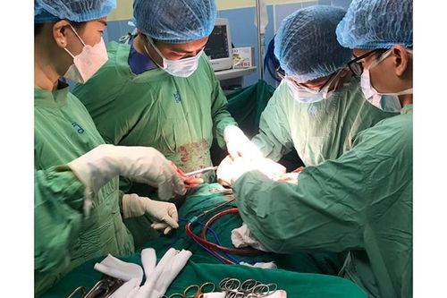 Phẫu thuật thành công cho bệnh nhân gãy xương đòn vai và có khối u tuyến giáp khổng lồ