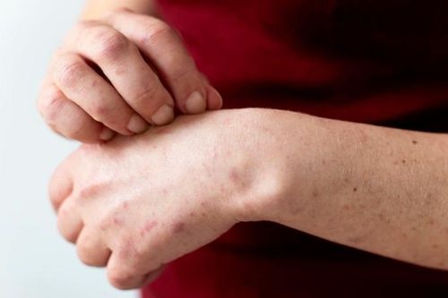 Những dấu hiệu trên da báo hiệu sớm bệnh tiểu đường