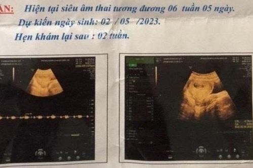 Hiếp dâm, giết người rồi tự sát: Ai phải chịu trách nhiệm bồi thường?