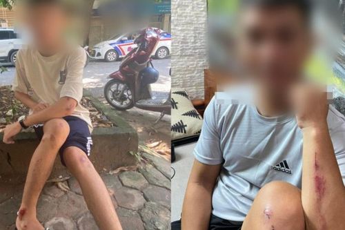 Nhiều người bị nhóm 'tóc xanh, tóc đỏ' vô cớ dùng vỏ chai bia tấn công khi đi đường ở Hà Nội