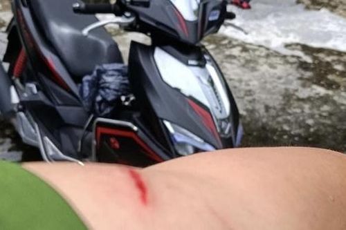 Một cán bộ Công an bị đối tượng ma túy tấn công gây thương tích
