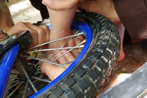 Phụ huynh bất cẩn, bé 2 tuổi dập nát gót chân vì kẹt vào nan xe đạp