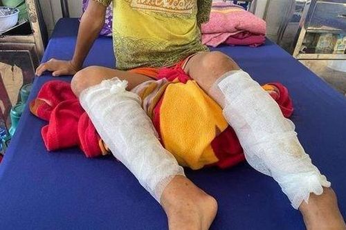 Quảng Bình: Công an vào cuộc điều tra vụ cháu bé bị cha đẻ đốt bỏng 2 chân