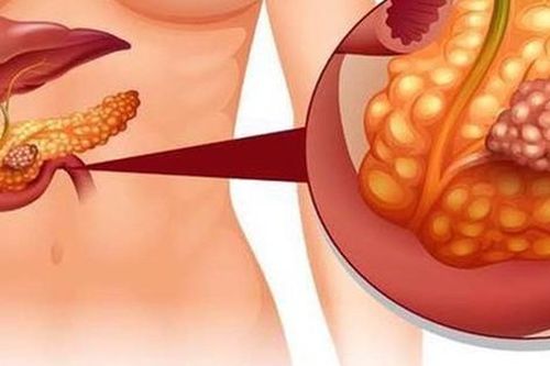 Người đàn ông có huyết tương trắng đục như sữa do thường xuyên nghiện những món khoái khẩu này