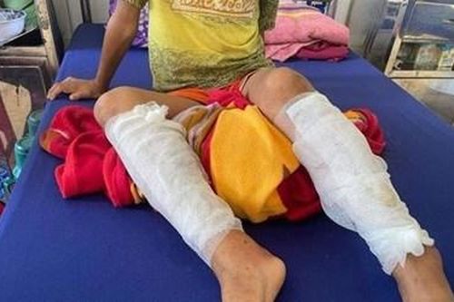 Công an vào cuộc vụ bố dùng rơm và xăng đốt chân con nhỏ