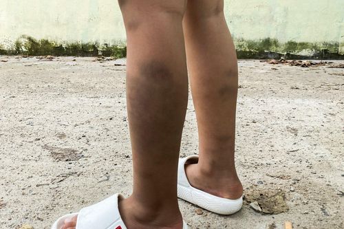 Đà Nẵng tăng cường giám sát trường học sau vụ trẻ lớp 1 bị đánh