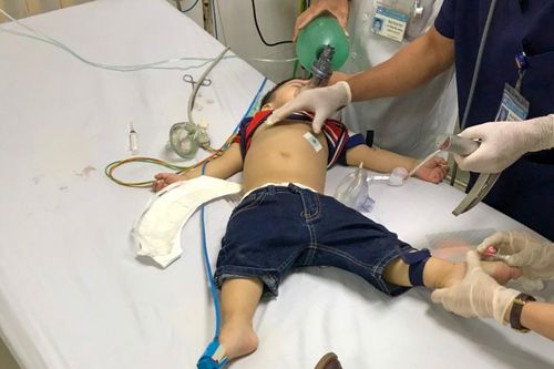 Cứu bé trai 22 tháng tuổi bị ngưng tim do hóc rau câu