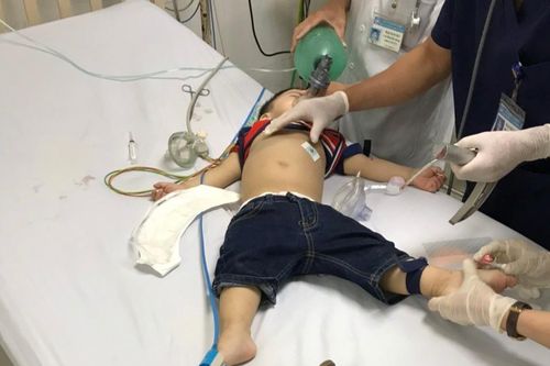 Bé trai bị hóc thạch rau câu dẫn đến ngưng tim