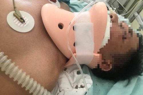 Truy tố 2 đối tượng liên quan đến vụ đánh người bất tỉnh trước cổng viện kiểm sát huyện