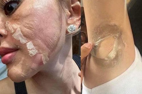 Bóc trần chiêu trò peel da như thật của 'vũ trụ hotgirl bán hàng online': Một cú lừa ngoạn mục!