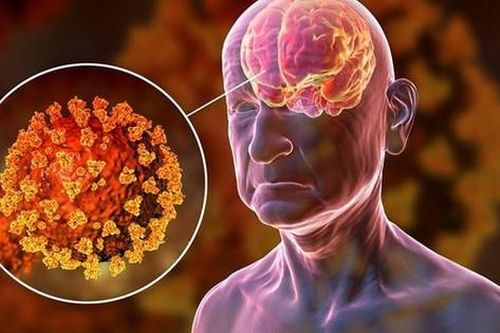 Phản ứng miễn dịch COVID-19 có thể ảnh hưởng đến não, gây ra các triệu chứng thần kinh