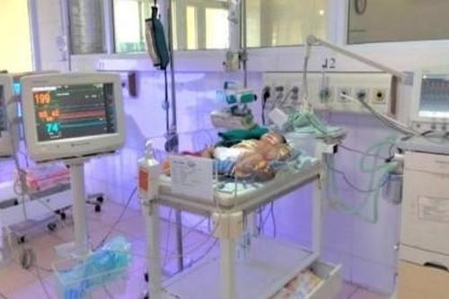 Cứu sống trẻ sơ sinh xuất huyết, tăng áp lực phổi rất nặng