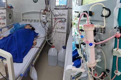 Máu đục như sữa, người phụ nữ suýt tử vong vì viêm tụy cấp