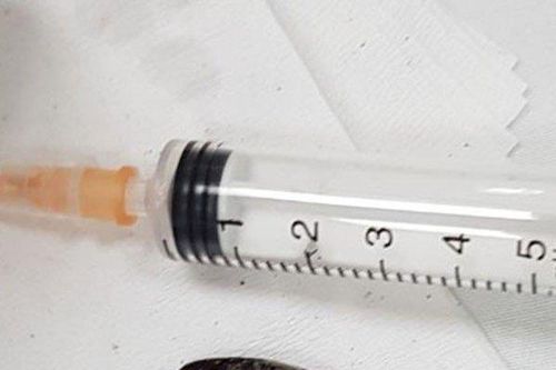 Bị ho 2 tháng không khỏi, bất ngờ phát hiện dị vật mắc kẹt trong phổi