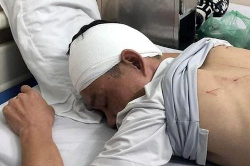 Khởi tố nhóm côn đồ xông vào bệnh viện truy sát người dân