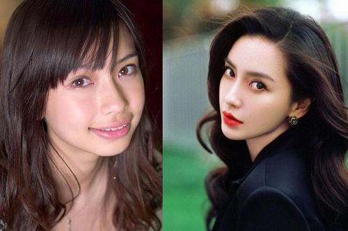 Nhan sắc người nổi tiếng thay đổi 360 độ sau khi niềng răng: Angela Baby là thành công nhất